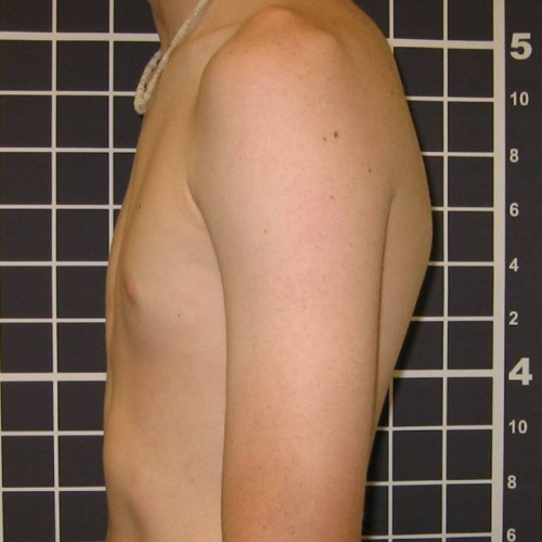 After image
