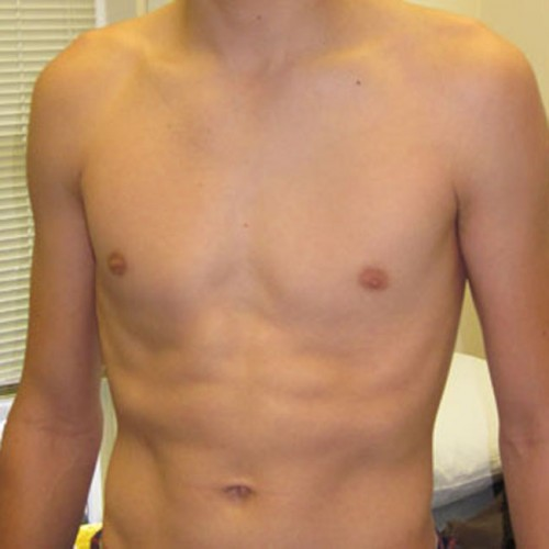 After image