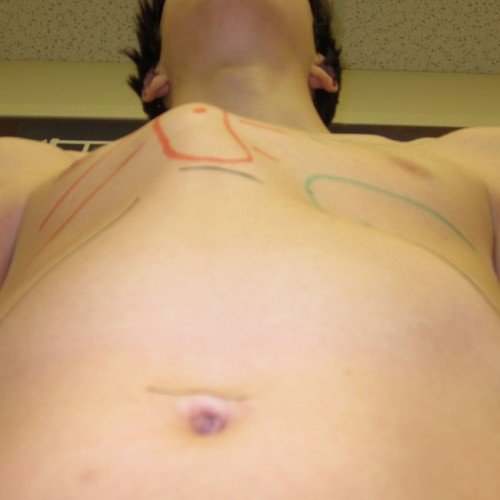 Before image