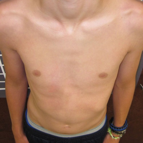After image