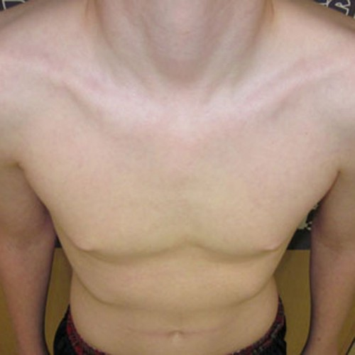 After image