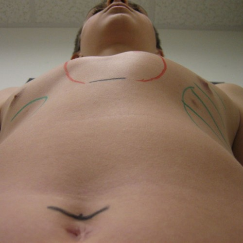 Before image