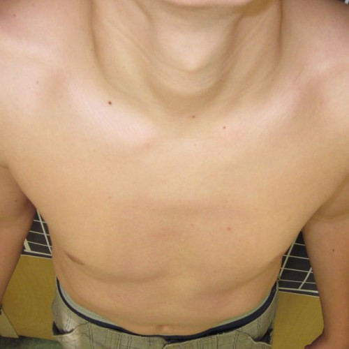 After image